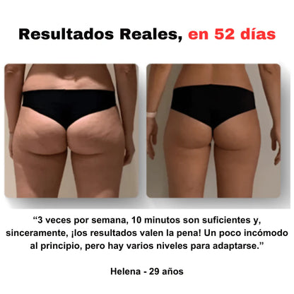 Masajeador anticelulítico